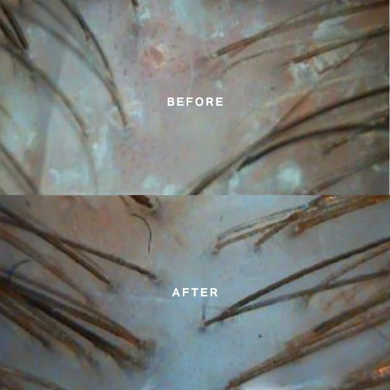Black Baccara Hair Multiplying Scalp Concentrate + Pre-Treatment Exfoliator 30 ml +10 ml - Image 5