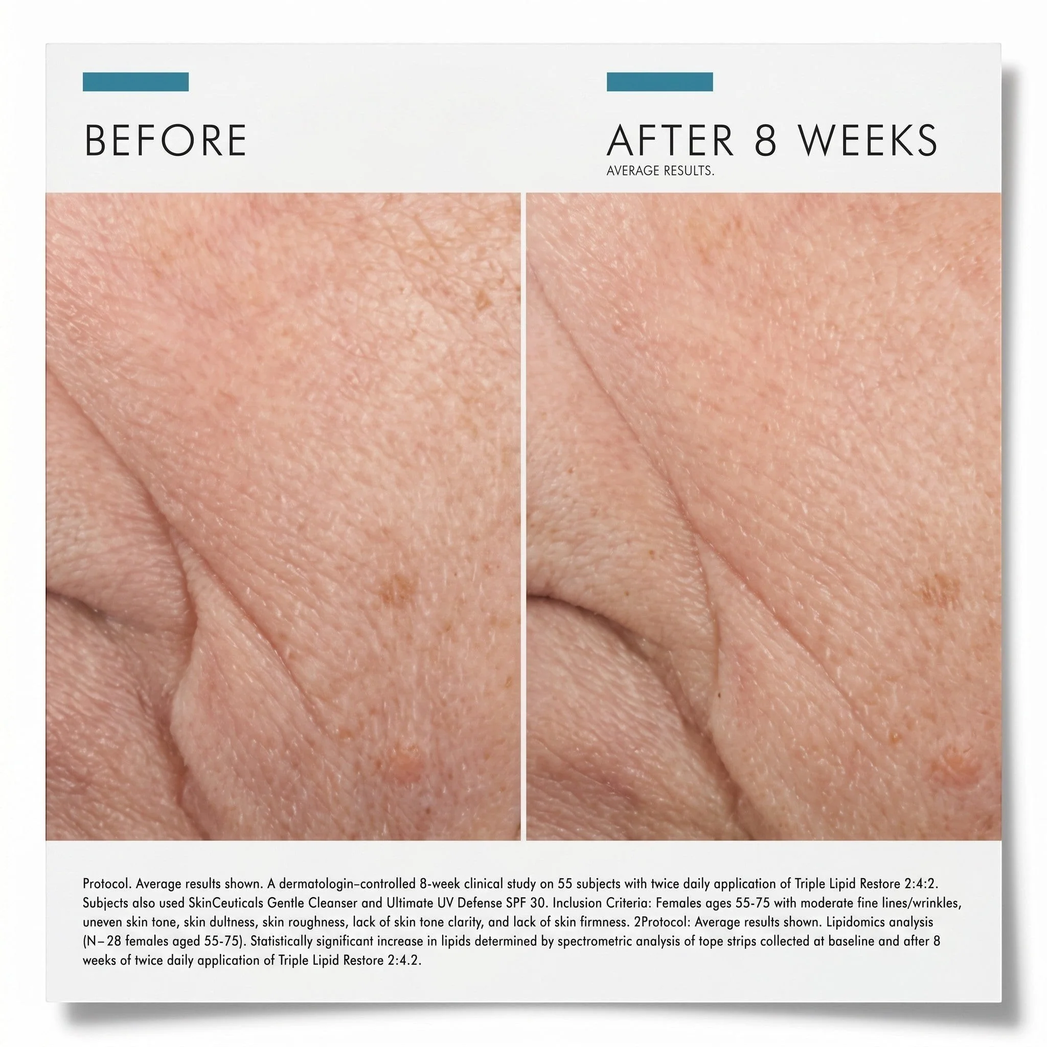 Triple Lipid Restore 2:4:2 - Image 6