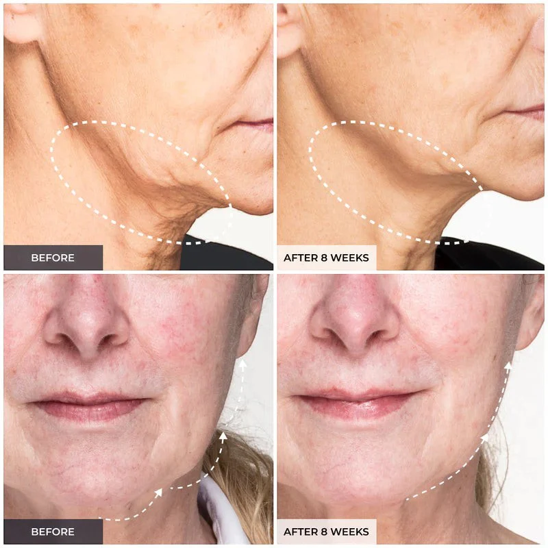 Medi Lift Essential Mask - Image 5